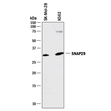 Western blot shows lysates of SK-Mel-28 human malignant melanoma cell line and K562 human chronic myelogenous leukemia cell line. PVDF membrane was probed with 2 µg/mL of Mouse Anti-Human SNAP29 Monoclonal Antibody (Catalog # MAB7869) followed by HRP-conjugated Anti-Mouse IgG Secondary Antibody (Catalog # HAF018). A specific band was detected for SNAP29 at approximately 29 kDa (as indicated). This experiment was conducted under reducing conditions and using Immunoblot Buffer Group 1.