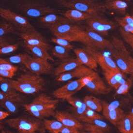 SNF1LK2 was detected in immersion fixed human adipocytes using 10 µg/mL Goat Anti-Human SNF1LK2 Antigen Affinity-purified Polyclonal Antibody (Catalog # AF5737) for 3 hours at room temperature. Cells were stained with the NorthernLights™ 557-conjugated Anti-Goat IgG Secondary Antibody (red; Catalog # NL001) and counterstained with DAPI (blue). View our protocol for Fluorescent ICC Staining of Cells on Coverslips.