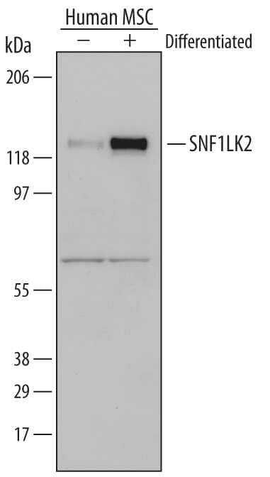 Western blot shows lysates of human mesenchymal stem cells (MSC) grown in the absence (-) or presence (+) of StemXVivo™ Adipogenic Supplement (Catalog # CCM001). PVDF membrane was probed with 1 µg/mL of Goat Anti-Human SNF1LK2 Antigen Affinity-purified Polyclonal Antibody (Catalog # AF5737), followed by HRP-conjugated Anti-Goat IgG Secondary Antibody (Catalog # HAF109). A specific band was detected for SNF1LK2 at approximately 125 kDa (as indicated). This experiment was conducted under reducing conditions and using Immunoblot Buffer Group 1.