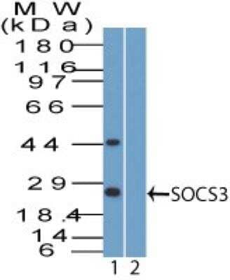 Western Blot: SOCS-3 Antibody [NBP2-27210] - Analysis of SOCS3. Jurkat lysate in the 1) absence and 2) presence of immunizing peptide probed with 4 ug/ml of SOCS3 antibody. I goat anti-rabbit Ig HRP secondary antibody and PicoTect ECL substrate solution were used for this test.