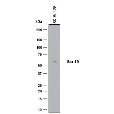     Western  blot shows lysates of SK‑Mel‑28 human malignant  melanoma cell line. PVDF membrane was probed with 2 µg/mL of Mouse  Anti-Human SOX10 Monoclonal Antibody (Catalog # MAB28643) followed by  HRP-conjugated Anti-Mouse IgG Secondary Antibody (Catalog # HAF018).  A specific band was detected for SOX10 at approximately 49 kDa (as  indicated). This experiment was conducted under reducing conditions and using  Immunoblot  Buffer Group 1. 