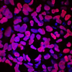 SOX17 was detected in immersion fixed iBJ6, an induced pluripotent stem (iPS) cell line, differentiated to endoderm using Goat Anti-Human SOX17 Biotinylated Antigen Affinity-purified Polyclonal Antibody (Catalog # BAF1924) at 10 µg/mL for 3 hours at room temperature. Cells were stained using the NorthernLights™ 557-conjugated Streptavidin (red; Catalog # NL999) and counterstained with DAPI (blue). Specific staining was localized to nuclei. View our protocol for Fluorescent ICC Staining of Stem Cells on Coverslips.