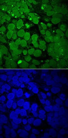 SOX3 was detected in immersion fixed NTera-2 human testicular embryonic carcinoma cell line differentiation with retinoic acid using Mouse Anti-Human SOX3 Monoclonal Antibody (Catalog # MAB2569) at 10 µg/mL for 3 hours at room temperature. Cells were stained using the NorthernLights™ 493-conjugated Anti-Mouse IgG Secondary Antibody (green, upper panel; Catalog # NL009) and counterstained with DAPI (blue, lower panel). View our protocol for Fluorescent ICC Staining of Cells on Coverslips.