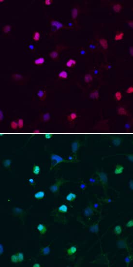 SOX6 was detected in immersion fixed 7-day differentiated rat cortical stem cells using Mouse Anti-Human SOX6 Monoclonal Antibody (Catalog # MAB7759) at 10 µg/mL for 3 hours at room temperature. Cells were stained using the NorthernLights™ 557-conjugated Anti-Mouse IgG Secondary Antibody (red, upper panel; Catalog # NL007). Olig2 was also detected in these cells using Goat Anti-Human Olig2 Affinity-purified Polyclonal Antibody (Catalog # AF2418). Cells were double-stained using the NorthernLights™ 493-conjugated Anti-Goat IgG Secondary Antibody (green, lower panel; Catalog # NL003) and counterstained with DAPI (blue). Specific staining was localized to nuclei of early oligodendrocytes and astrocytes. View our protocol for Fluorescent ICC Staining of Cells on Coverslips.