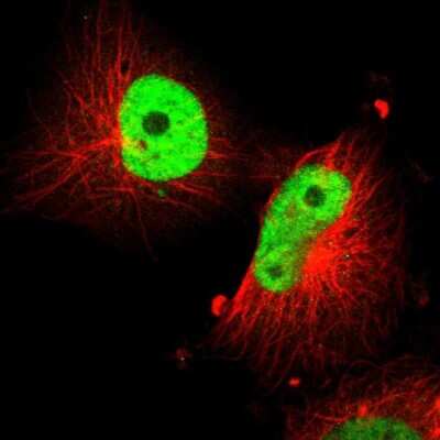 Immunocytochemistry/Immunofluorescence: SOX9 Antibody [NBP1-85551] - Staining of human cell line U-251 MG shows localization to nucleoplasm. Antibody staining is shown in green.