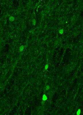 Immunohistochemistry-Frozen: SOX9 Antibody [NBP2-24659] - Feline optic nerve tissue section was incubated with antibody at 1:200 and further stained with Alexa secondary antibody. Image was captured with an epifluorescence microscope. This image was submitted via customer review.