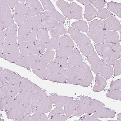 Immunohistochemistry-Paraffin: SOX9 Antibody [NBP1-85551] - Staining of human skeletal muscle shows no nuclear positivity in striated muscle fibers as expected.
