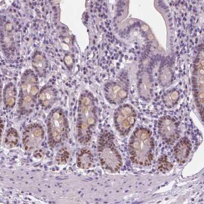 Immunohistochemistry-Paraffin: SOX9 Antibody [NBP1-85551] - Staining of human small intestine shows moderate nuclear positivity in a subset of glandular cells.