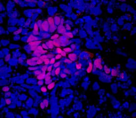     SOX9  was detected in immersion fixed BGO1V human embryonic stem cells  differentiated to early proximal lung progenitors using Goat Anti-Human SOX9  Biotinylated Antigen Affinity-purified Polyclonal Antibody (Catalog #  BAF3075) at 10 µg/mL for 3 hours at room temperature.  Cells were stained using the NorthernLights™ 557-conjugated  Streptavidin (red; Catalog # NL999)  and counterstained with DAPI (blue). Specific staining was localized to  nuclei. View our protocol for Fluorescent  ICC Staining of Stem Cells on Coverslips. 