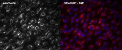 Immunocytochemistry/Immunofluorescence: SPARC Antibody [NBP1-80972] - Staining  SPARC in MG63 cells using anti-SPARC antibody. Cell were fixed in 4% Paraformaldehyde  (20 min, RT); and permeabilized in 0,2% Triton (15 min, RT). Image from verified customer review.