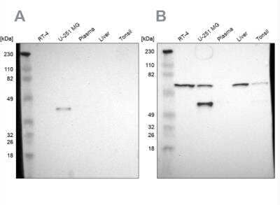 Western Blot: SPARC Antibody [NBP1-80972] - Analysis using Anti-SPARC antibody NBP1-80972 (A) shows similar pattern to independent antibody NBP1-80971 (B).