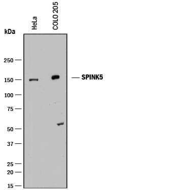 Western blot shows lysates of HeLa human cervical epithelial carcinoma cell line and COLO 205 human colorectal adenocarcinoma cell line. PVDF membrane was probed with 0.5 µg/mL of Rabbit Anti-Human SPINK5 Antigen Affinity-purified Polyclonal Antibody (Catalog # AF8515) followed by HRP-conjugated Anti-Rabbit IgG Secondary Antibody (Catalog # HAF008). A specific band was detected for SPINK5 at approximately 150 kDa (as indicated). This experiment was conducted under reducing conditions and using Immunoblot Buffer Group 1.