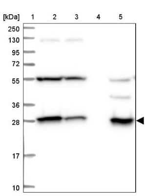 SPR Antibody (NBP1-87060): Novus Biologicals