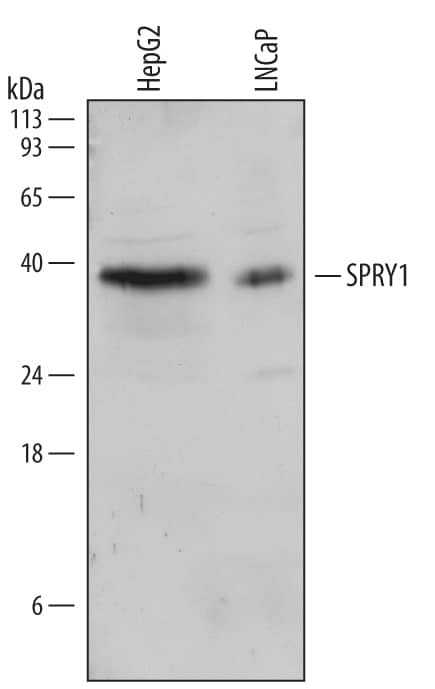 Western Blot SPRY1 Antibody [Unconjugated]