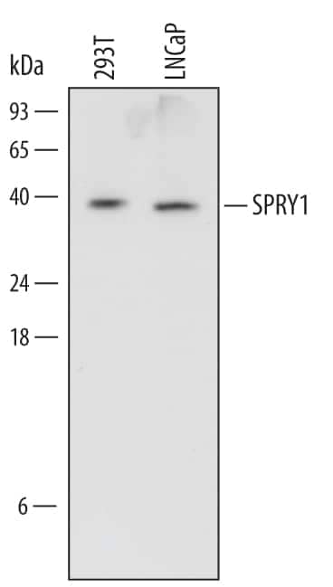 Western blot shows lysates of 293T human embryonic kidney cell line and LNCaP human prostate cancer cell line. PVDF Membrane was probed with 0.5 µg/mL of Human SPRY1 Monoclonal Antibody (Catalog # MAB6097) followed by HRP-conjugated Anti-Mouse IgG Secondary Antibody (Catalog # HAF007). A specific band was detected for SPRY1 at approximately 37 kDa (as indicated). This experiment was conducted under reducing conditions and using Immunoblot Buffer Group 1.