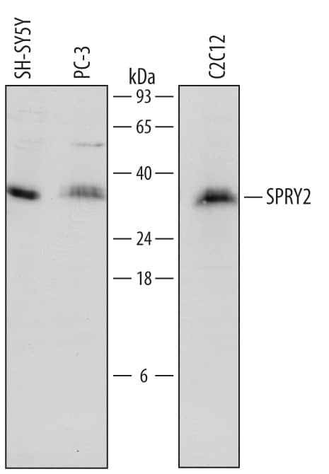 Western blot shows lysates of SH-SY5Y human neuroblastoma cell line, PC-3 human prostate cancer cell line, and C2C12 mouse myoblast cell line. PVDF Membrane was probed with 1 µg/mL of Goat Anti-Human/Mouse SPRY2 Antigen Affinity-purified Polyclonal Antibody (Catalog # AF6157) followed by HRP-conjugated Anti-Goat IgG Secondary Antibody (Catalog # HAF109). A specific band was detected for SPRY2 at approximately 35 kDa (as indicated). This experiment was conducted under reducing conditions and using Immunoblot Buffer Group 1.