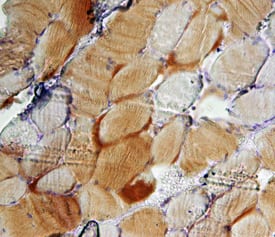 SRPK3 was detected in immersion fixed paraffin-embedded sections of human skeletal muscle using Mouse Anti-Human SRPK3 Monoclonal Antibody (Catalog # MAB72301) at 15 µg/mL overnight at 4 °C. Tissue was stained using the Anti-Mouse HRP-DAB Cell & Tissue Staining Kit (brown; Catalog # CTS002) and counterstained with hematoxylin (blue). Specific staining was localized to muscle cell cytoplasm. View our protocol for Chromogenic IHC Staining of Paraffin-embedded Tissue Sections.