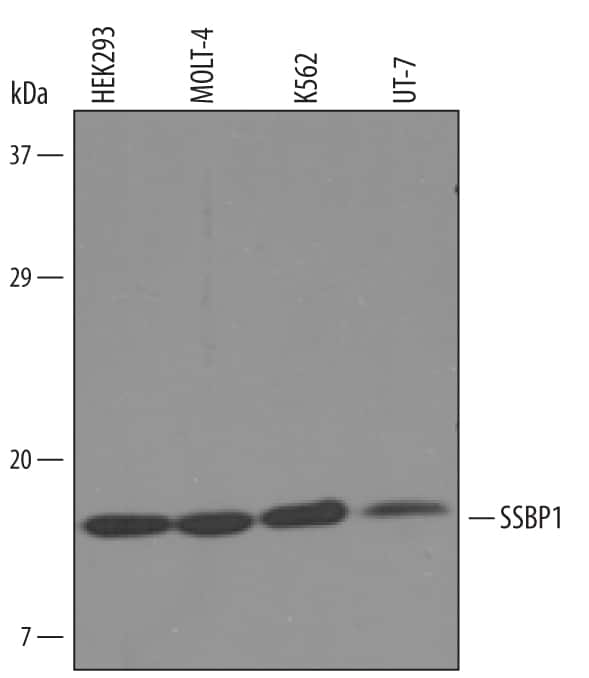 Western blot shows lysates of HEK293 human embryonic kidney cell line, MOLT-4 human acute lymphoblastic leukemia cell line, K562 human chronic myelogenous leukemia cell line, and UT-7 human acute myeloid leukemia cell line. PVDF Membrane was probed with 1 µg/mL of Sheep Anti-Human SSBP1 Antigen Affinity-purified Polyclonal Antibody (Catalog # AF6588) followed by HRP-conjugated Anti-Sheep IgG Secondary Antibody (Catalog # HAF016). A specific band was detected for SSBP1 at approximately 18 kDa (as indicated). This experiment was conducted under reducing conditions and using Immunoblot Buffer Group 8.