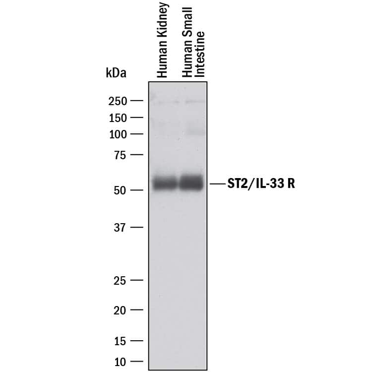 Western blot shows lysates of human kidney tissue and small intestine tissue. PVDF membrane was probed with 2 µg/mL of Rabbit Anti-Human ST2/IL-33 R Monoclonal Antibody (Catalog # MAB5233) followed by HRP-conjugated Anti-Rabbit IgG Secondary Antibody (Catalog # HAF008). A specific band was detected for ST2/IL-33 R at approximately 50-55 kDa (as indicated). This experiment was conducted under reducing conditions and using Immunoblot Buffer Group 1.