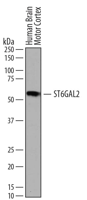 Western Blot ST6 Gal Sialyltransferase 2/ST6GAL2 Antibody