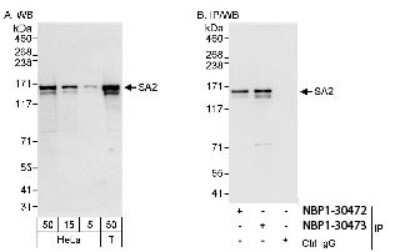 STAG2 Antibody (NBP1-30473): Novus Biologicals