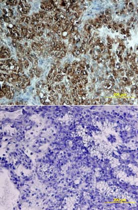 STAT2 was detected in immersion fixed paraffin-embedded sections of human kidney array using Mouse Anti-Human STAT2 Monoclonal Antibody (Catalog # MAB16661) at 25 µg/mL overnight at 4 °C. Tissue was stained using the Anti-Mouse HRP-DAB Cell & Tissue Staining Kit (brown; Catalog # CTS002) and counterstained with hematoxylin (blue). Lower panel shows a lack of labeling if primary antibodies are omitted and tissue is stained only with secondary antibody followed by incubation with detection reagents. View our protocol for Chromogenic IHC Staining of Paraffin-embedded Tissue Sections.