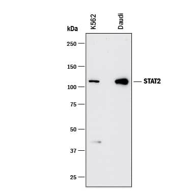 Western blot shows lysates of K562 human chronic myelogenous leukemia cell line and Daudi human Burkitt's lymphoma cell line. PVDF membrane was probed with 1 µg/mL of Rat Anti-Human STAT2 Monoclonal Antibody (Catalog # MAB16662) followed by HRP-conjugated Anti-Rat IgG Secondary Antibody (Catalog # HAF005). A specific band was detected for STAT2 at approximately 110 kDa (as indicated). This experiment was conducted under reducing conditions and using Immunoblot Buffer Group 1.