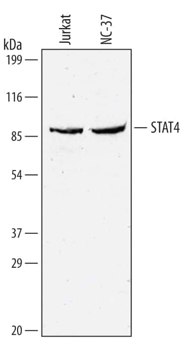 Western blot shows lysates of Jurkat human acute T cell leukemia cell line and NC-37 human Burkitt's lymphoma B lymphoblast cell line. PVDF membrane was probed with 1 µg/mL of Human/Mouse STAT4 Monoclonal Antibody (Catalog # MAB5287) followed by HRP-conjugated Anti-Mouse IgG Secondary Antibody (Catalog # HAF007). A specific band was detected for STAT4 at approximately 90 kDa (as indicated). This experiment was conducted under reducing conditions and using Immunoblot Buffer Group 1.