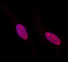 STAT5a/b phosphorylated at Y694/Y699 was detected in immersion fixed HeLa human cervical epithelial carcinoma cell line using Rat Anti-Human Phospho-STAT5a/b (Y694/Y699) Monoclonal Antibody (Catalog # MAB4190) at 0.3 µg/mL for 3 hours at room temperature. Cells were stained using the NorthernLights™ 557-conjugated Anti-Rat IgG Secondary Antibody (red; Catalog # NL013) and counterstained with DAPI (blue). Specific staining was localized to nuclei. View our protocol for Fluorescent ICC Staining of Cells on Coverslips.