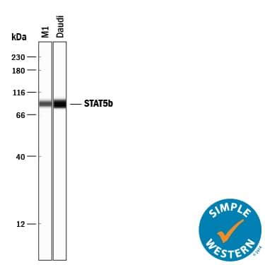 Simple Western lane view shows lysates of M1 mouse myeloid leukemia cell line and Daudi human Burkitt's lymphoma cell line, loaded at 0.2 mg/mL. A specific band was detected for STAT5b at approximately 90 kDa (as indicated) using 1  μg/mL of Rabbit Anti-Human/Mouse/Rat STAT5b Monoclonal Antibody (Catalog # MAB15841) . This experiment was conducted under reducing conditions and using the 12-230 kDa separation system.        