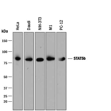 Western blot shows lysates of HeLa human cervical epithelial carcinoma cell line, Daudi human Burkitt's lymphoma cell line, NIH-3T3 mouse embryonic fibroblast cell line, M1 mouse myeloid leukemia cell line, and PC-12 rat adrenal pheochromocytoma cell line. PVDF membrane was probed with 0.1 µg/mL of Rabbit Anti-Human/Mouse/Rat STAT5b Monoclonal Antibody (Catalog # MAB15841) followed by HRP-conjugated Anti-Rabbit IgG Secondary Antibody (HAF008). A specific band was detected for STAT5b at approximately 90 kDa (as indicated). This experiment was conducted under reducing conditions and using Immunoblot Buffer Group 1.