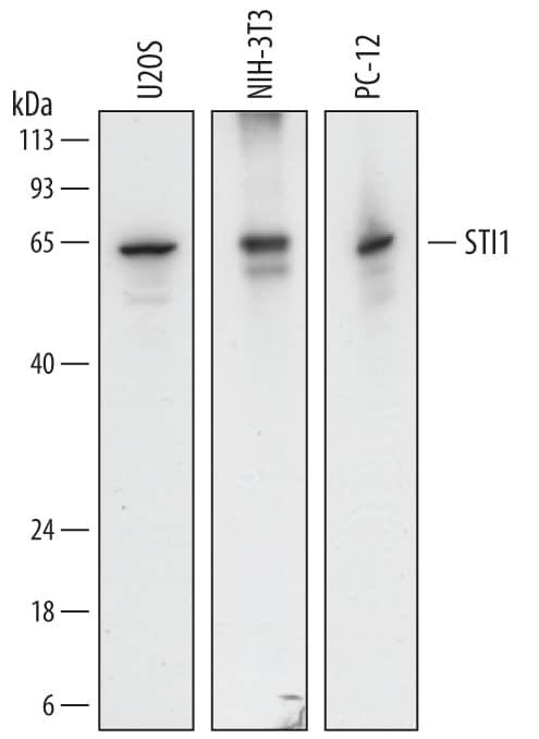 Western blot shows lysates of U2OS human osteosarcoma cell line, NIH-3T3 mouse embryonic fibroblast cell line, and PC-12 rat adrenal pheochromocytoma cell line. PVDF membrane was probed with 0.1 µg/mL of Sheep Anti-Human/Mouse/Rat STI1 Antigen Affinity-purified Polyclonal Antibody (Catalog # AF7337) followed by HRP-conjugated Anti-Sheep IgG Secondary Antibody (Catalog # HAF016). A specific band was detected for STI1 at approximately 62 kDa (as indicated). This experiment was conducted under reducing conditions and using Immunoblot Buffer Group 1.