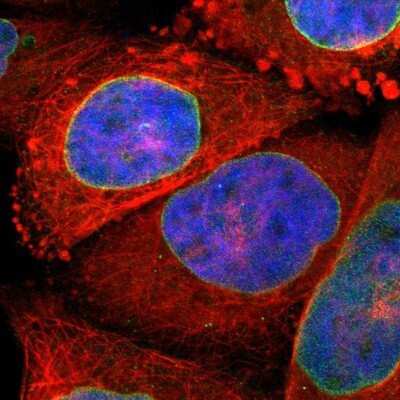 Immunocytochemistry/Immunofluorescence: SUN1 Antibody [NBP1-87396] - Staining of human cell line A-431 shows positivity in nuclear membrane. Antibody staining is shown in green.