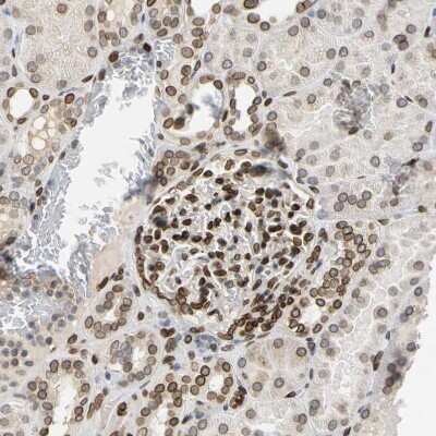 Immunohistochemistry-Paraffin: SUN1 Antibody [NBP1-87396] - Staining of human kidney shows strong positivity in nuclear membrane in cells in glomeruli.
