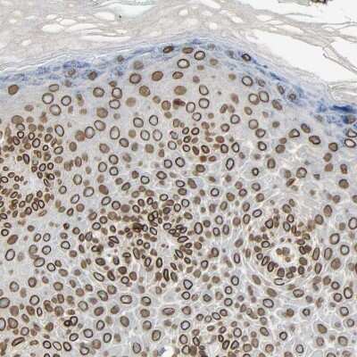 Immunohistochemistry-Paraffin: SUN1 Antibody [NBP1-87396] - Staining of human skin shows strong positivity in nuclear membrane in squamous epithelial cells.