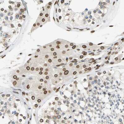 Immunohistochemistry-Paraffin: SUN1 Antibody [NBP1-87396] - Staining of human testis shows strong positivity in nuclear membrane in Leydig cells.