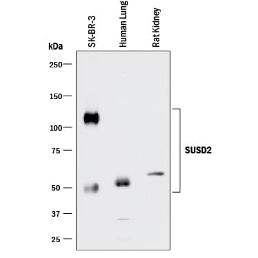 Western blot shows lysates of SK-BR-3 human breast cancer cell line, human lung tissue, and rat kidney tissue. PVDF membrane was probed with 1 µg/mL of Rabbit Anti-Human/Rat SUSD2 Monoclonal Antibody (Catalog # MAB90563) followed by HRP-conjugated Anti-Rabbit IgG Secondary Antibody (Catalog # HAF008). Specific bands were detected for SUSD2 at approximately 110 and 50-60 kDa (as indicated). This experiment was conducted under reducing conditions and using Immunoblot Buffer Group 1.