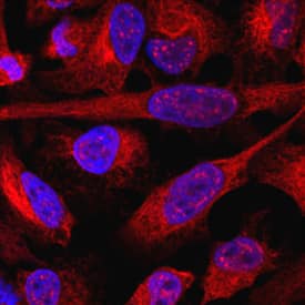 SUZ12 was detected in immersion fixed HeLa human cervical epithelial carcinoma cell line using Sheep Anti-Human SUZ12 Antigen Affinity-purified Polyclonal Antibody (Catalog # AF4184) at 10 µg/mL for 3 hours at room temperature. Cells were stained using the NorthernLights™ 557-conjugated Anti-Sheep IgG Secondary Antibody (red; Catalog # NL010) and counterstained with DAPI(blue). Specific staining was localized to nucleus and cytoplasm. View our protocol for Fluorescent ICC Staining of Cells on Coverslips.