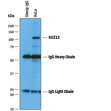 Immunoprecipitation SUZ12 Antibody [Unconjugated]