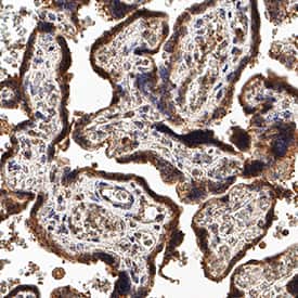 Immunohistochemistry SVEP1 Antibody (982903) [Unconjugated]