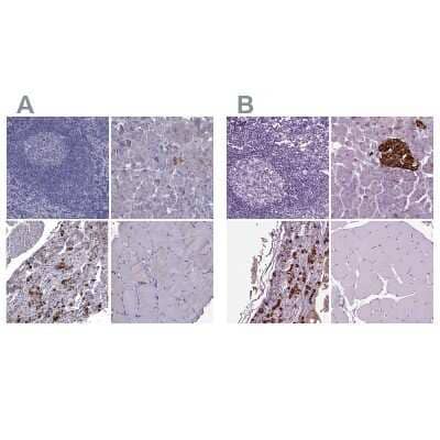 Secretogranin V Antibody (NBP2-68983): Novus Biologicals