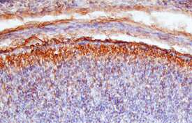 Semaphorin 4G was detected in immersion fixed frozen sections of mouse embryo (15 d.p.c.) using Sheep Anti-Mouse Semaphorin 4G Antigen Affinity-purified Polyclonal Antibody (Catalog # AF6504) at 15 µg/mL overnight at 4 °C. Tissue was stained using the Anti-Sheep HRP-DAB Cell & Tissue Staining Kit (brown; Catalog # CTS019) and counter-stained with hematoxylin (blue). Specific staining was localized to developing brain (cortex) and connective tissue. View our protocol for Chromogenic IHC Staining of Frozen Tissue Sections.