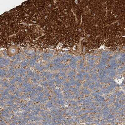 Immunohistochemistry-Paraffin: Septin-4 Antibody [NBP1-90093] - Staining of human cerebellum shows strong cytoplasmic positivity in neuropil.