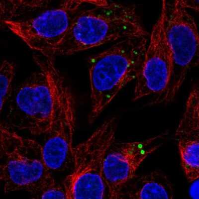 Serpin A1/alpha 1-Antitrypsin Antibody (NBP1-90308): Novus Biologicals