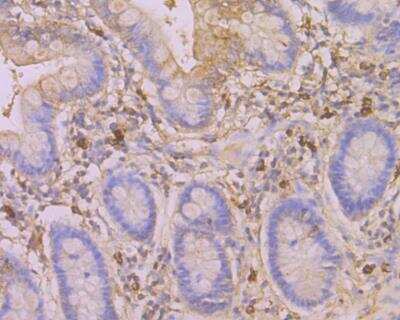 Immunohistochemistry: Serpin C1/Antithrombin-III Antibody [NBP2-76966] - Immunohistochemical analysis of paraffin-embedded human small intestine tissue using anti-SERPINC1 antibody. Counter stained with hematoxylin.