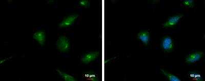 Immunocytochemistry/Immunofluorescence: SerpinB2 Antibody [NBP1-33188] - HeLa cells were fixed in 4% paraformaldehyde at RT for 15 min. Green: PAI2 protein stained by PAI2 antibody  diluted at 1:500. Blue: Hoechst 33342 staining. Scale bar = 10 um.