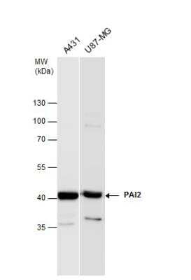 Western Blot: SerpinB2 Antibody [NBP1-33188] - Various whole cell extracts (30 ug) were separated by 10% SDS-PAGE, and the membrane was blotted with PAI2 antibody diluted at a dilution of 1:1000. The HRP-conjugated anti-rabbit IgG antibody (NBP2-19301) was used to detect the primary antibody.