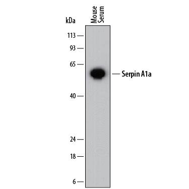 Western blot shows mouse serum. PVDF membrane was probed with 0.2 µg/mL of Rat Anti-Mouse Serpin A1a Monoclonal Antibody (Catalog # MAB7690) followed by HRP-conjugated Anti-Rat IgG Secondary Antibody (Catalog # HAF005). A specific band was detected for Serpin A1a at approximately 50-55 kDa (as indicated). This experiment was conducted under reducing conditions and using Immunoblot Buffer Group 1.