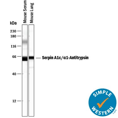     Simple  Western lane view shows mouse serum and lysates of mouse lung tissue, loaded  at 0.2 mg/mL. A specific band was detected for Serpin  A1c/ alpha 1‑Antitrypsin at approximately 62 kDa (as indicated)  using 5 µg/mL of Goat Anti-Mouse Serpin  A1c/ alpha 1‑Antitrypsin Antigen Affinity-purified Polyclonal Antibody  (Catalog # AF2979) followed by 1:50 dilution of HRP-conjugated Anti-Goat IgG  Secondary Antibody (Catalog # HAF109).  This experiment was conducted under reducing conditions and using the 12-230  kDa separation system.         