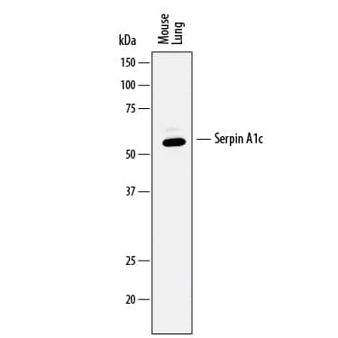 Western blot shows lysates of mouse lung tissue. PVDF membrane was probed with 0.5 µg/mL of Goat Anti-Mouse Serpin A1c/a1-Antitrypsin Antigen Affinity-purified Polyclonal Antibody (Catalog # AF2979) followed by HRP-conjugated Anti-Goat IgG Secondary Antibody (Catalog # HAF017). A specific band was detected for Serpin A1c/a1-Antitrypsin at approximately 55 kDa (as indicated). This experiment was conducted under reducing conditions and using Immunoblot Buffer Group 1.